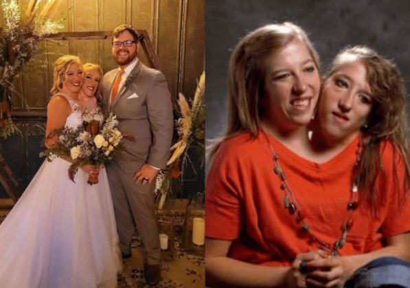 Conjoined Twins Abby Hensel Gets Married To Her Fianc E Josh Bowling