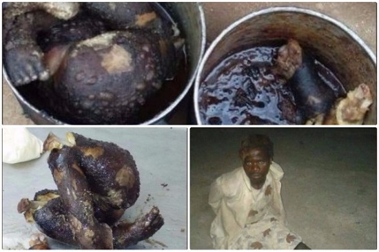 Woman Caught Cooking and Eating A Baby Her Reasons Will Shock You [Graphic Photos]