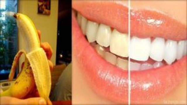 Steps To Whiten Your Teeth Using a Banana Peel in Just 15 days 