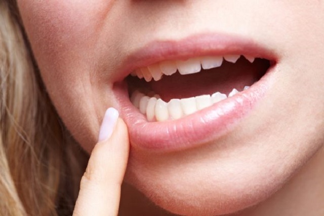 9 Things Your Lips Say About Your Health—[Tingling Lips May Signify a Stroke is coming]