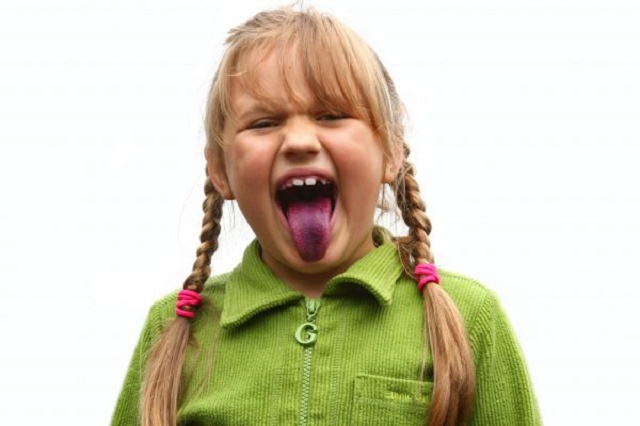 6 Things Your Tongue Says About Your Health [Bright Red Tongue Means See A Doctor]