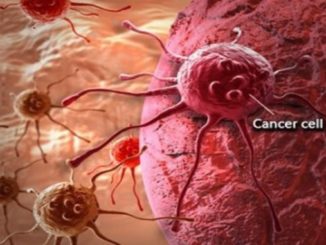 Three Types of Cancers That Kills Men, And How to Spot them before It’s Too Late