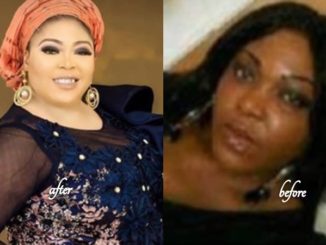 I Identity of the Lady behind Viral Skin Bleaching Procedure Revealed [Video]