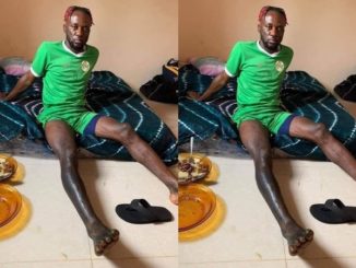 Prominent Sierra Leone Striker Mohamed Buya Turay Shows Off What Black Magic Did To His Leg [photos]