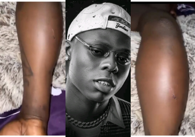 “He was in pain till the end” – Leaked video shows Mohbad’s bloated arm few hours before his demise