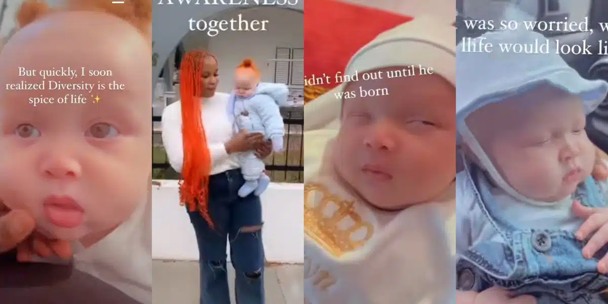  “He is so cute"-Reactions as Nigerian lady shows off her handsome son with type 3 albinism