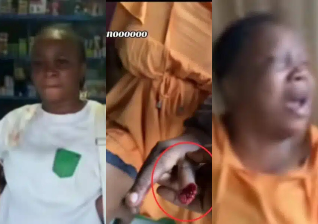 Nigerian woman bites off finger of husband’s side chick