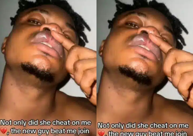 Nigerian man shares how girlfriend's new boyfriend beats him up