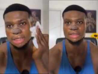 Zicsaloma shares video after his 3-week nose surgery, narrates why he did it