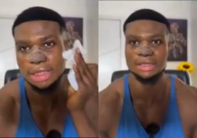 Zicsaloma shares video after his 3-week nose surgery, narrates why he did it