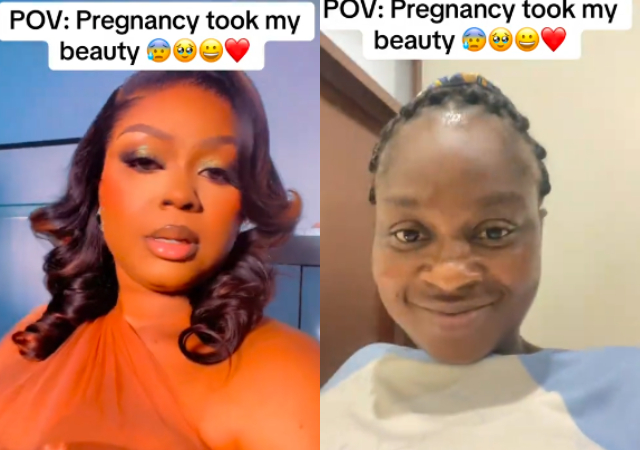 Lady lament as she shares facial transformation after getting pregnant