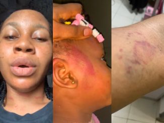 Woman cries out, exposes abusive husband who beats & locked her out after miscarriage