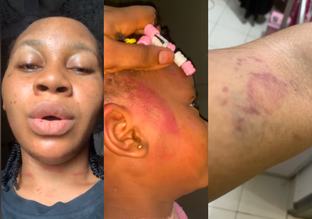 Woman cries out, exposes abusive husband who beats & locked her out after miscarriage